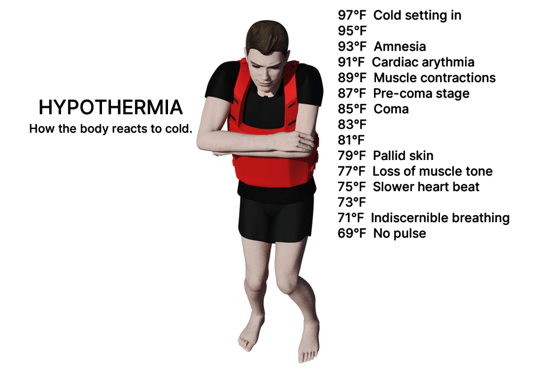 Hypothermia - Symptoms & Treatment